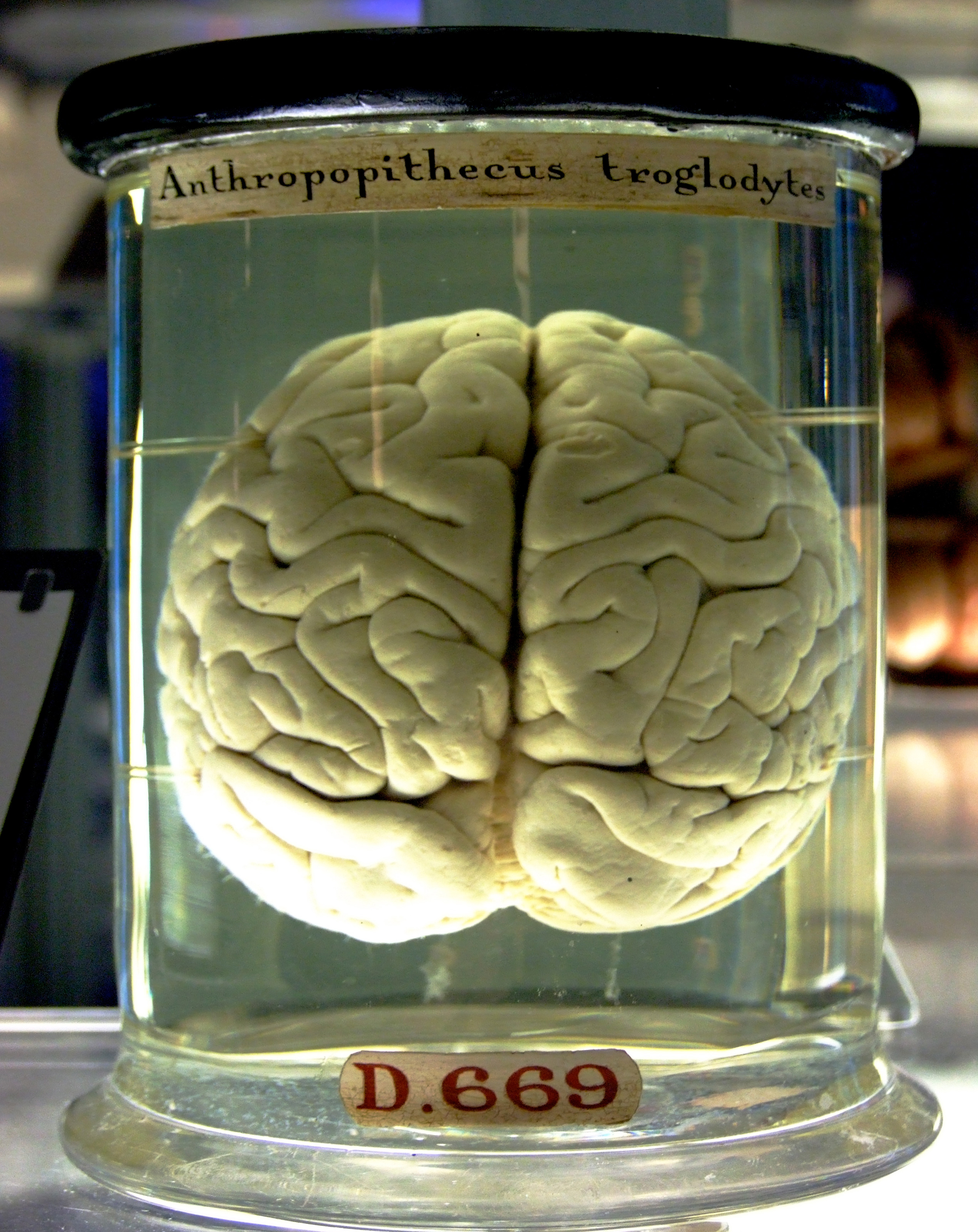 Chimp_Brain_in_a_jar