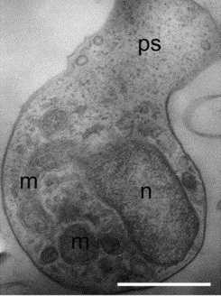 Zoósporo ameboide de Amoeboaphelidium protococcarum. ps = pseudopódio, m = mitocôndria, n = núcleo celular. Escala da barra: 1 μm.