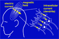 Magnetoencefalografia