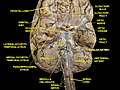 Cerebrum.Inferior view. Deep dissection