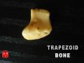 Trapezoid bone.