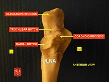 Ulna3.jpg