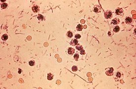 Shigella-bakteereita ulostenäytteessä