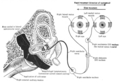 A image of the caloric reflex test