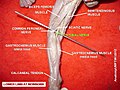 Tibial nerve