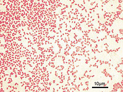 Pseudomonas aeruginosa zabarwione na kolor czerwony, Gram-ujemne