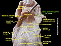 Lateral glossoepiglottic fold