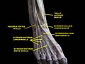 Sektionspräparat mit dem Musculus extensor digitorum brevis