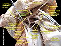 Maxillary artery