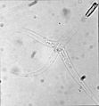 Image 40Myxozoans such as Myxobolus cerebralis are single-celled parasites, never more than 20 μm across. (from Animal)