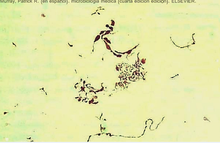 Photomicrograph of bacteria in intermediate-length chains