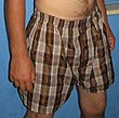 Boxer shorts