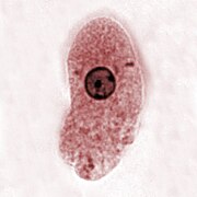 Entamoeba histolytica