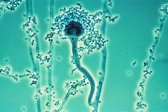 Conidiofoor van Aspergillus fumigatus