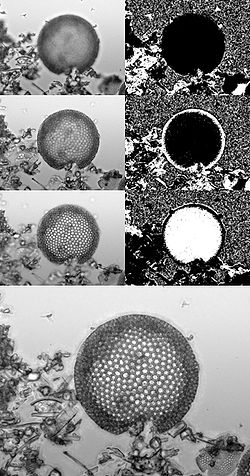 Focus stacking in microscopy