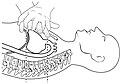 The ejection of blood from the heart is conditioned by the compression of the sternum by a third of the height of the chest.