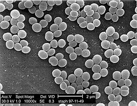 Skaneeriva elektronmikroskoobi mikrofoto stafülokoki Staphylococcus aureus kolooniatest. Stafülokokkidele iseloomulikult on bakterid rühmitunud kobarateks.