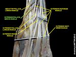 Extensor pollicis brevis muscle