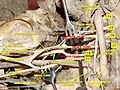 Brachial plexus