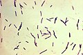 Clostridium perfringens