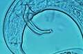 雄線虫と突起状の生殖器