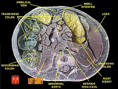 Cross-section through a cadaveric specimen showing the position of the kidneys