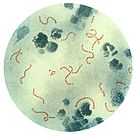 Streptococcus pyogenes