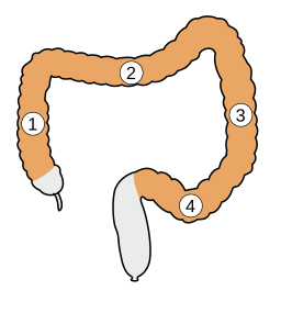 alt=Schematische voorstelling van de onderdelen van de karteldarm: 1. Colon ascendens 2. Colon transversum 3. Colon descendens 4. Colon sigmoideum