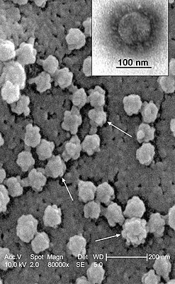 Severe acute respiratory syndrome-related coronavirus (SARSCoV)