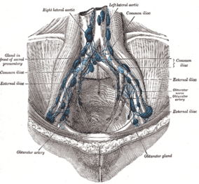 Image showing the external iliac lymph nodes and their positions around the external iliac artery and vein