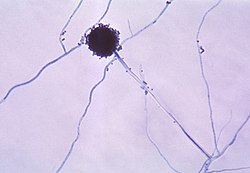 Aspergillus niger.