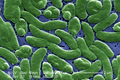 Image 37Vibrio vulnificus, a virulent bacterium found in estuaries and along coastal areas (from Marine prokaryotes)