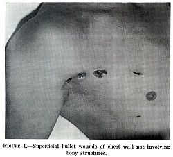 Chapter1figure1-Superficial bullet wound.jpg