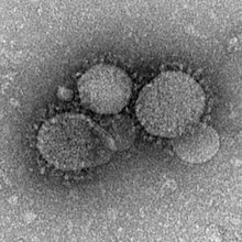 MERS-CoV-partikler set med elektronmikroskop. Viruspartiklerne har karakteristiske kronelignende pigge på membrankappen[1] Tilhører virusgruppe IV