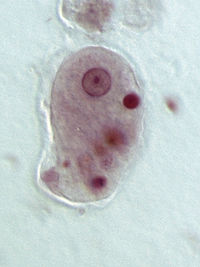 Entamoeba histolytica trofozoit