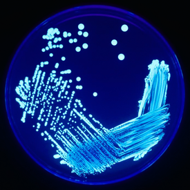 Legionella sp. под ультрафиолетовым излучением