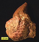 Ohio'nun Alt Karbonifer Dönemi'nden kalma bir deniz zambağı calyx ve ona yapışık bulunan konik platikeratit bir karındanbacaklı (Palaeocapulus acutirostre)