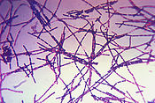 Bacillus anthracis, an bakteriom a gaws anthraks