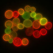 Membrane cellulaire de levure, mise en évidence de structure (en jaune) obtenue par fusion de protéines de la membrane avec deux marqueurs fluorescents (RFP et GFP).