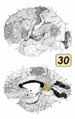 Brodmann area 30