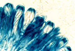 Apothecium met asci van Lecanora strobilina