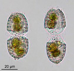 Coleps sp. en division.