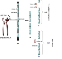 Cromosoma X. Genopatia recessiva lligada al braç curt del cromosoma X (locus Xp21)