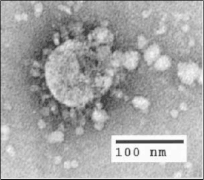 Electron micrograph of SARS coronavirus virion