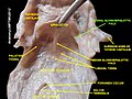 Lateral glossoepiglottic fold