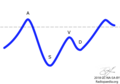 Normal spectral Doppler waveform of hepatic venous flow