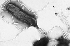 СЕМ мікрофотографія бактерії H. pylori.