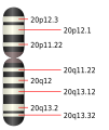 Chromosome 20