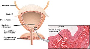 Links: Schematische Darstellung der anatomischen Verhältnisse zwischen Harnblase und Harnröhre, Rechts: Blick aus dem Inneren der Harnblase, dem Trigonum vesicae und als dem Ursprungsort der Urethra die zentral liegende Öffnung der inneren Harnröhrenmündung (Ostium urethrae internum)