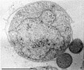 Image 10Two Nanoarchaeum equitans cells with its larger host Ignicoccus (from Marine prokaryotes)